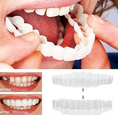 Magic Smile Teeth Brace 【Can eatting】100% non-inductive fit, no foreign body sensation！😁 (💥45% OFF) - 🔥HOT SALE🔥🎉