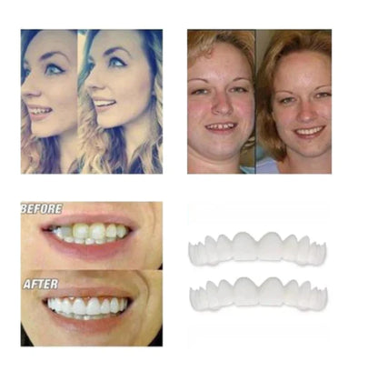 Magic Smile Teeth Brace 【Can eatting】100% non-inductive fit, no foreign body sensation！😁 (💥45% OFF) - 🔥HOT SALE🔥🎉